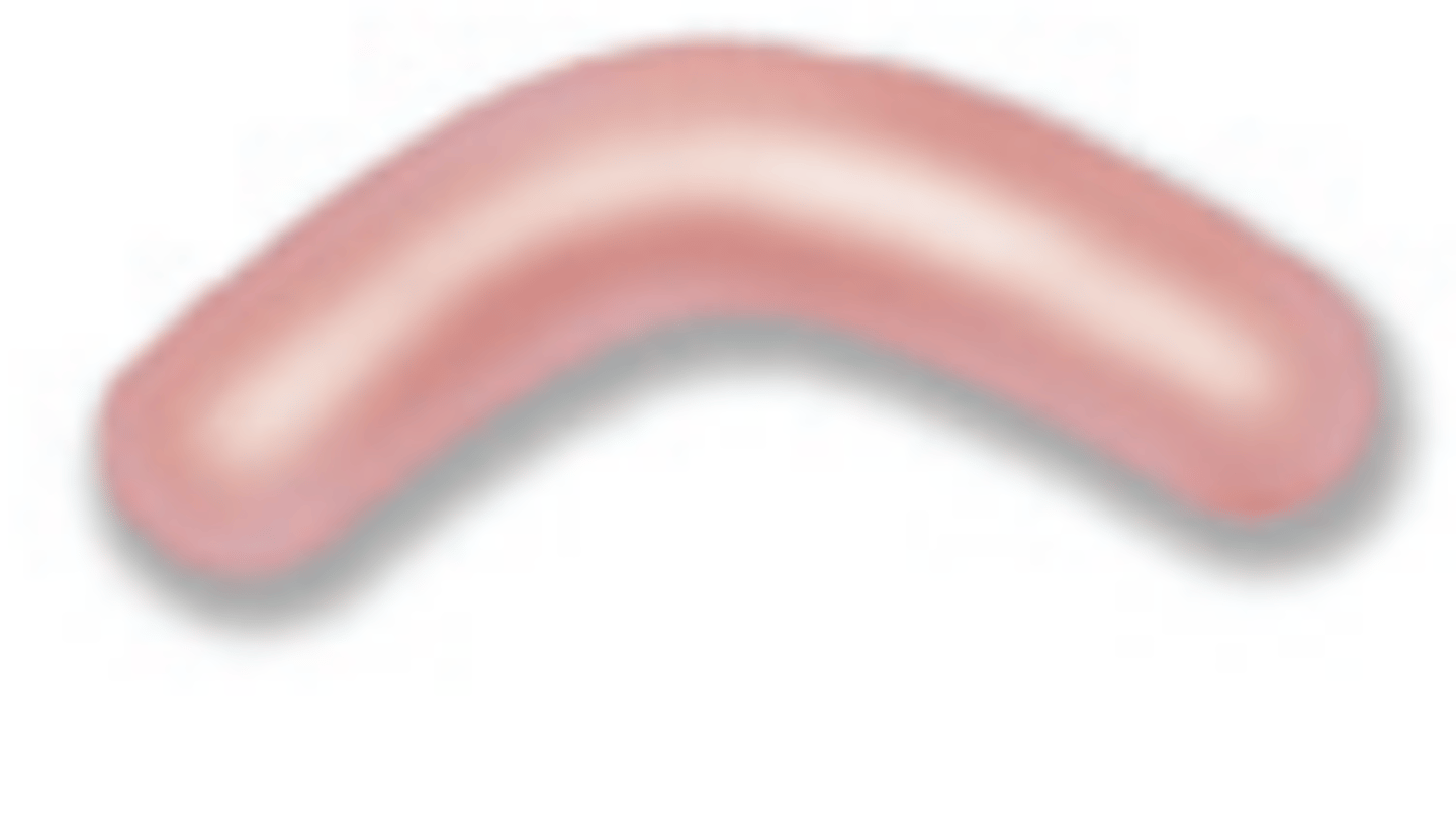 <p>What is the morphology of the bacteria shown?</p>