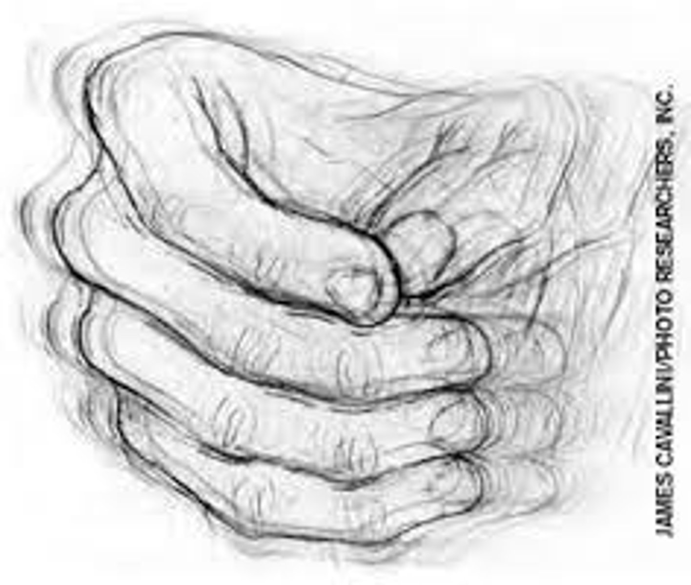 <p>Flexing and extending the fingers while moving the thumb back and forth. Characteristic of Parkinson's.</p>