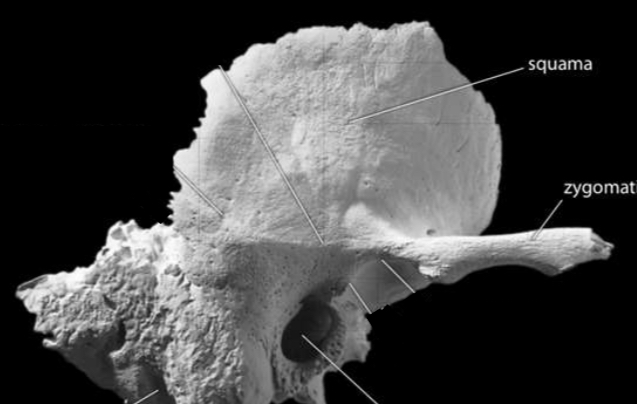 <p>Identify the external acoustic meatus</p>