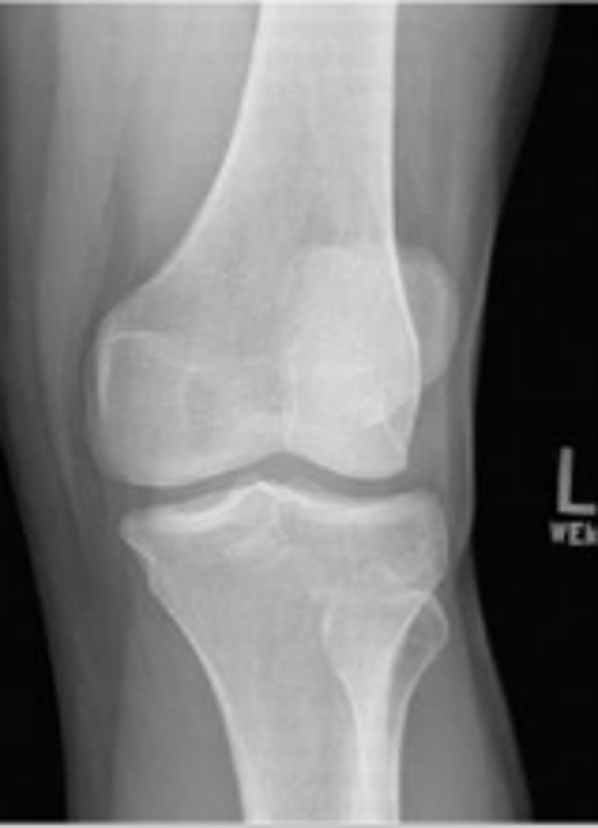 <p>What is radiographic view?</p>