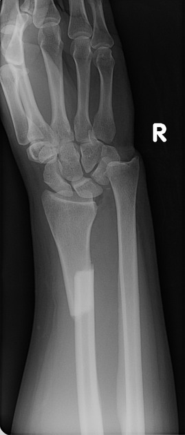term image