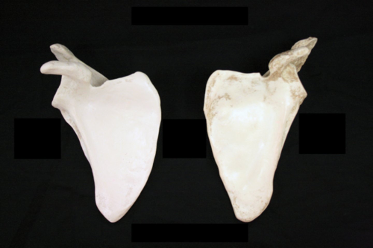 <p>anterior view</p>