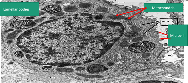 <p>Type II pneumocyte</p>