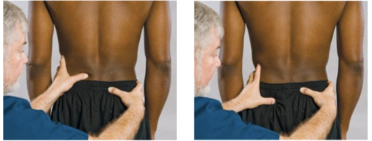 <p>Assessment for:</p><p>- SI joints</p>