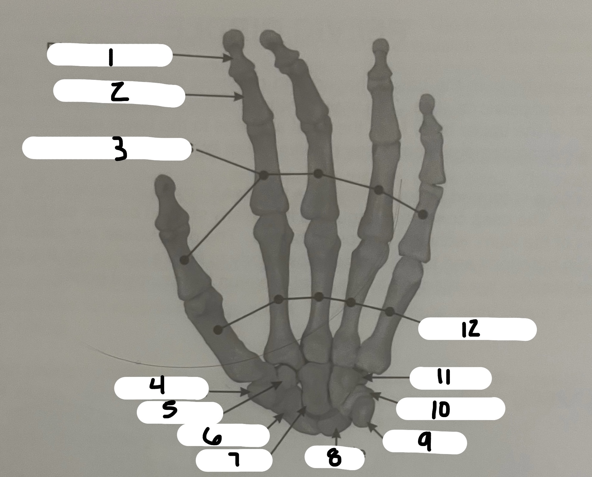 <p>What’s the name of the structure labeled #10?</p>