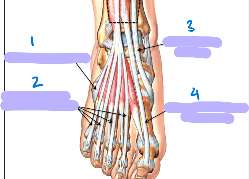 <p>identify these tendons</p>