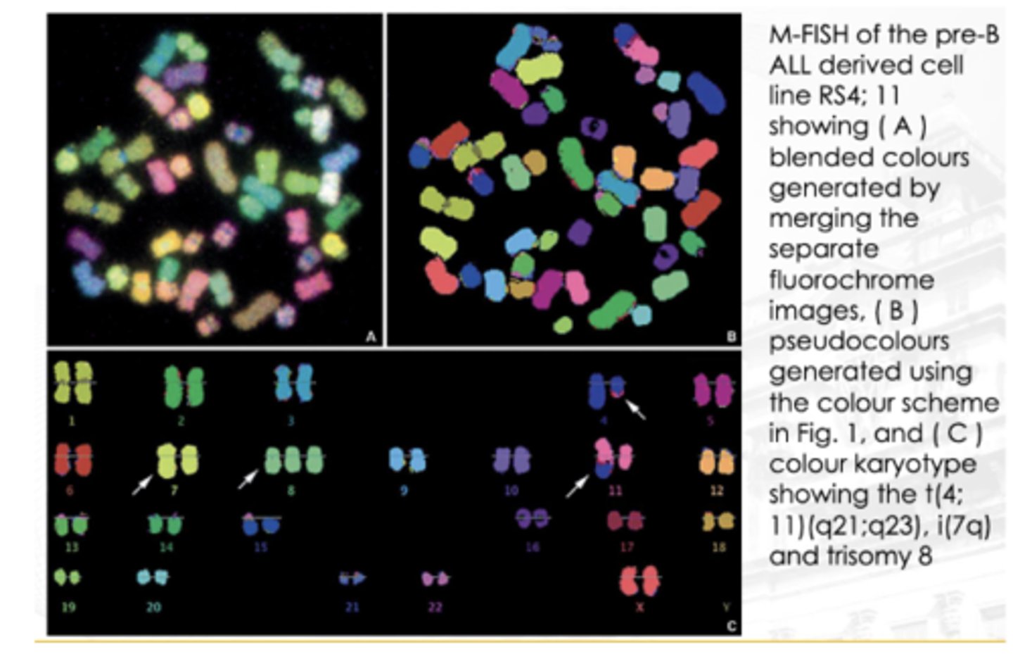 <p>A technique that allows the investigator to view a karyotype so that each chromosome is “painted” with a different color</p><p>Ratio-labeled probes are used to create a distinct computer-generated false color for each chromosome</p><p>Useful for complex rearrangements, such as those seen in neoplastic disorders and solid tumors</p>
