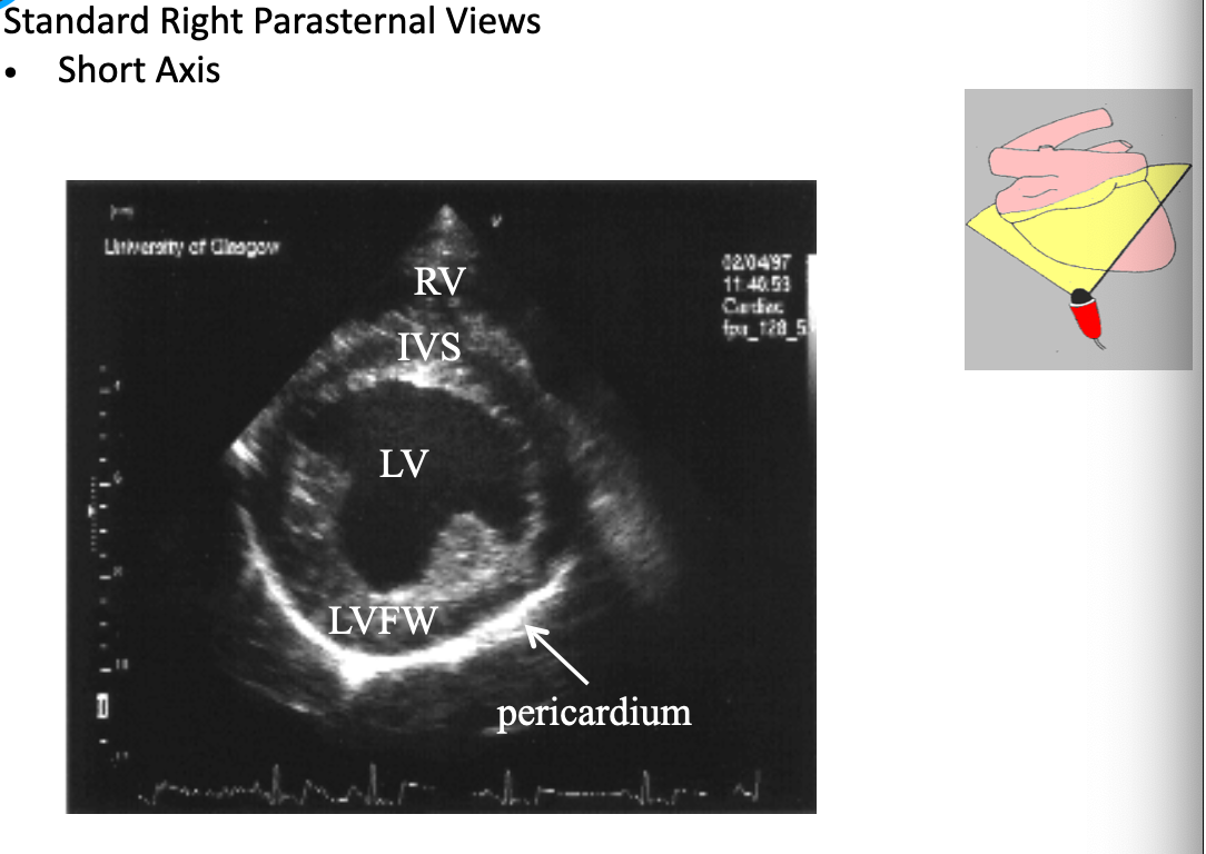 <ul><li><p><span><strong><span>Orientation:</span></strong><span> The ultrasound beam is aligned perpendicular to the long axis of the heart, roughly parallel with IC space, usually with the marker pointing toward the dog's right shoulder (craniodorsal).</span></span></p></li><li><p>Gives view of the short axis</p></li><li><p>LV = mushroom shape</p></li></ul><p></p>