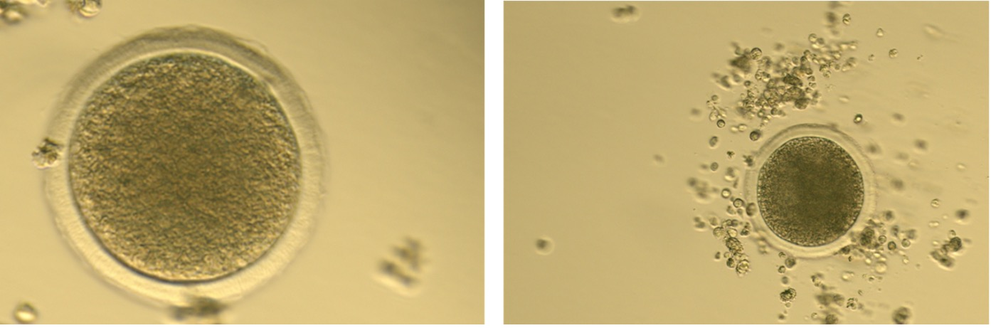 <p>What is the thick ring around the oocyte?</p>