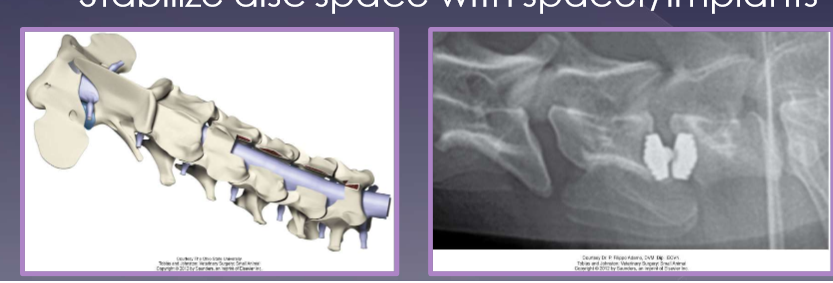 <ul><li><p>direct decompression: static lesions </p><ul><li><p>ventral slot </p></li><li><p>dorsal laminectomy </p></li></ul></li><li><p>distraction - stabilization: dynamic lesions </p><ul><li><p>decompress disc protrusion </p></li><li><p>stabilize disc space with spacer / implants </p></li></ul></li><li><p>neurologic deterioration </p><ul><li><p>most significant with a continuous laminectomy (70%) </p></li></ul></li><li><p>domino effect </p><ul><li><p>adjacent segment syndrome (20%) </p></li><li><p>mainly with distraction - stabilization techniques </p></li><li><p>altered biomechanics at operated sited leads to stress/load at adjacent site </p></li></ul></li><li><p>up to ~80% improvement </p></li><li><p>risk of recurrence -25% </p></li></ul><p></p>
