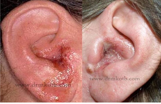 <p>What is this disorder</p>