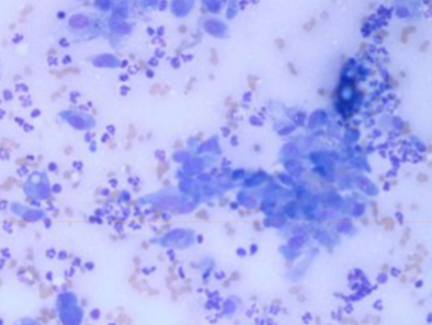 <p>is&nbsp;<span style="color: rgb(255, 255, 255);"><span>Blastomyces dermatitidis zoonotic&nbsp;</span></span></p>