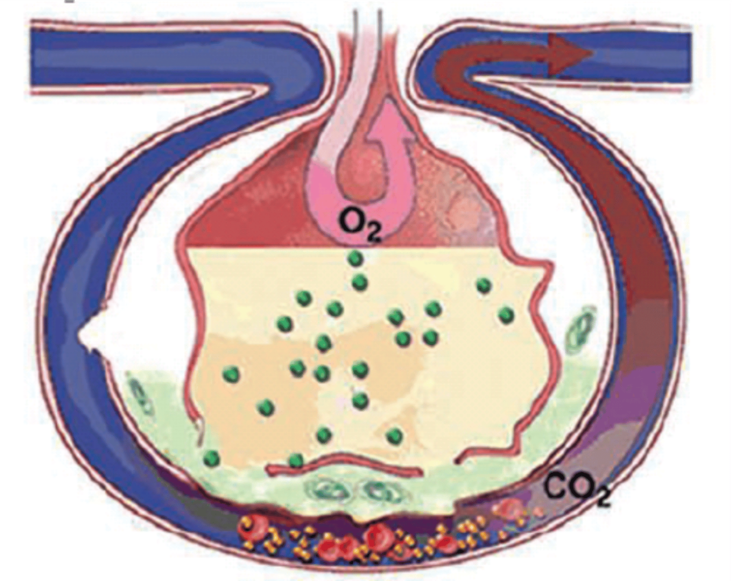 <p>formation of scar tissue in the lungs.</p><p>Scar tissue is thicker and less elastic than normal lung tissue.</p>