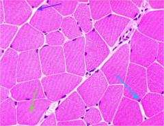 many nuclei around edges