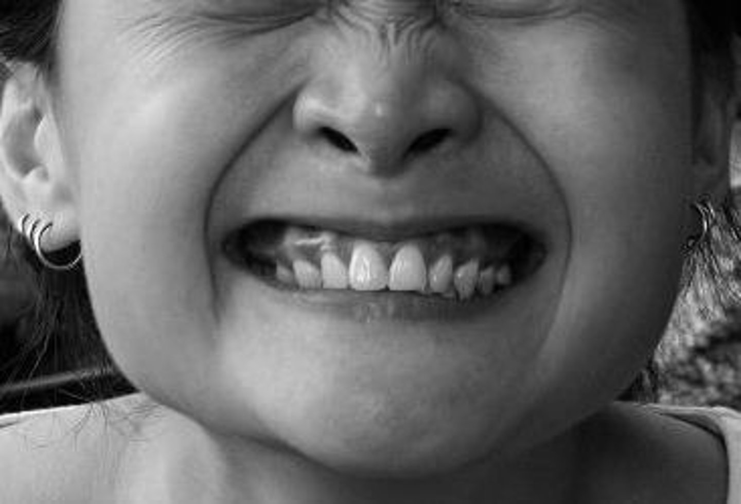 <p>Pathogen: Clostridium tetani</p><p>S+S: Spasms of the masseter, neck and respiratory muscles, opisthotonus</p><p>Reservoirs: Soil contaminated with animal or human feces</p><p>Transmission: Bacteria enter an open wound from soil</p>