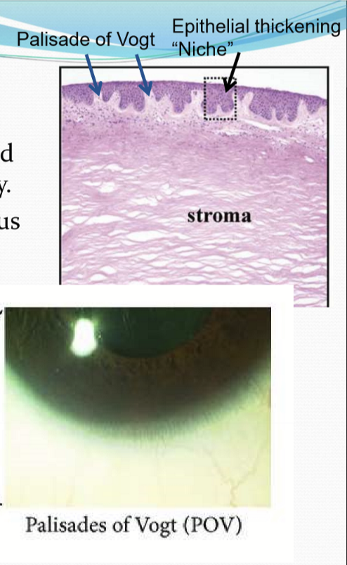 <p>A region that protects a stem cell population and helps maintain their multipotency. This is seen as epithelial thickenings in the limbus.</p>