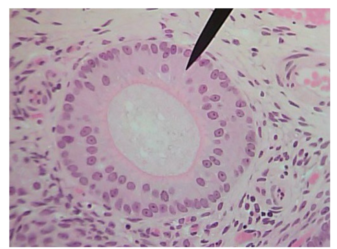<p>Early secondary follicle </p>