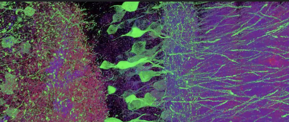 <p>Fluorescence Microscopy (Epi)</p>