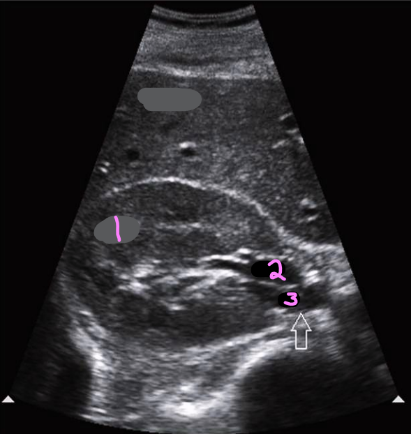 <p>Label this trans kidney image</p>