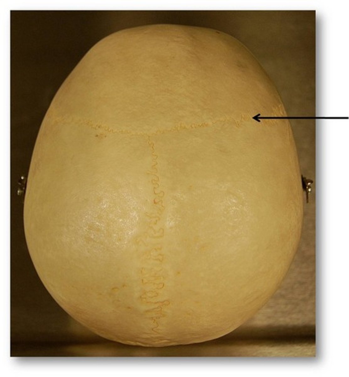 <p>Name this bony suture</p>