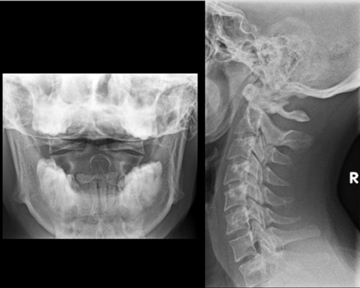 <p>Can you adjust this patient?</p>