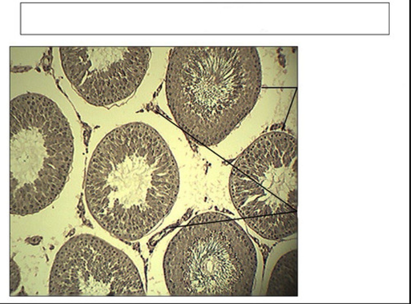 <p>identify this organ</p>