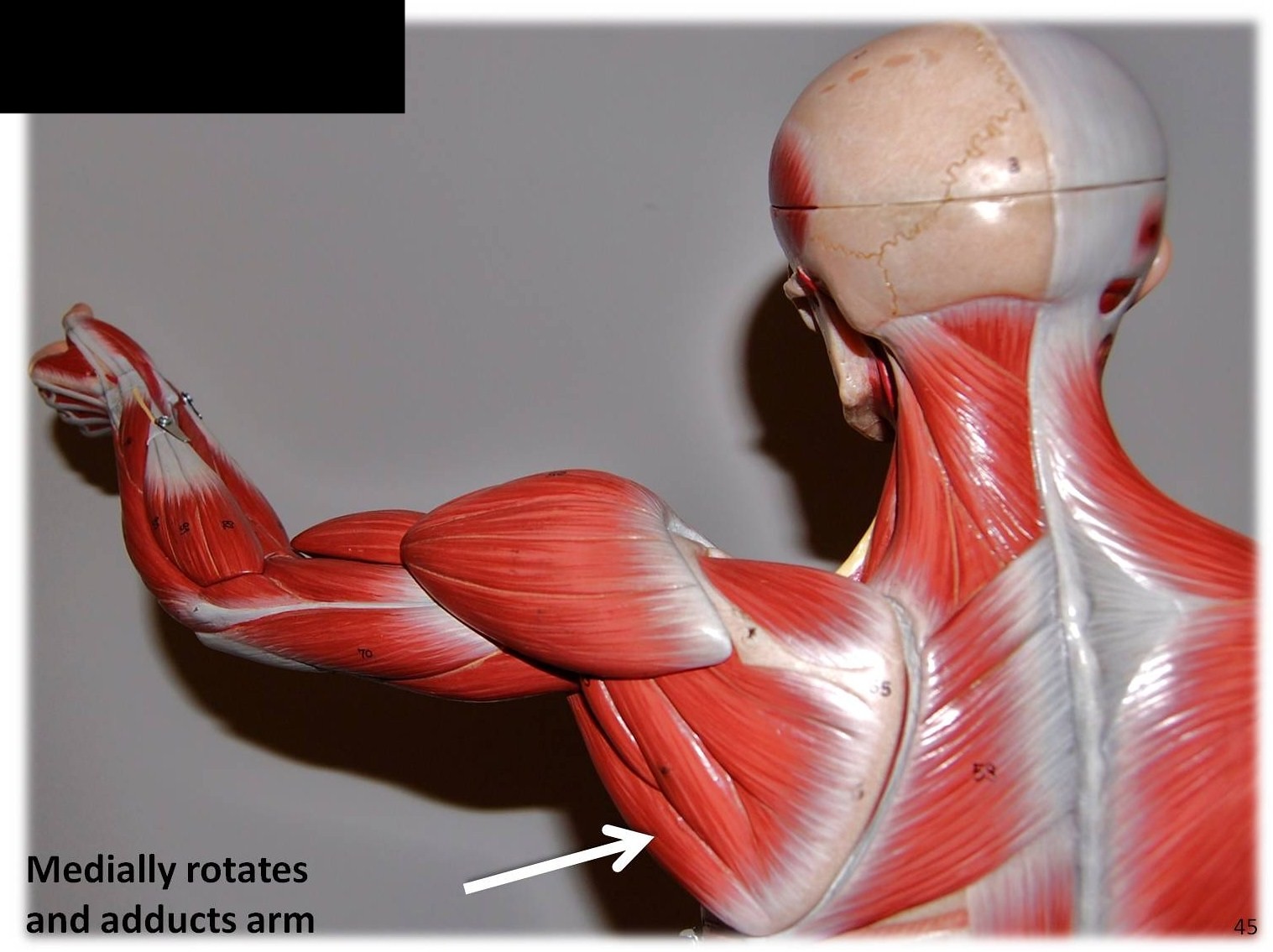 <p>What muscle is this?*****</p>