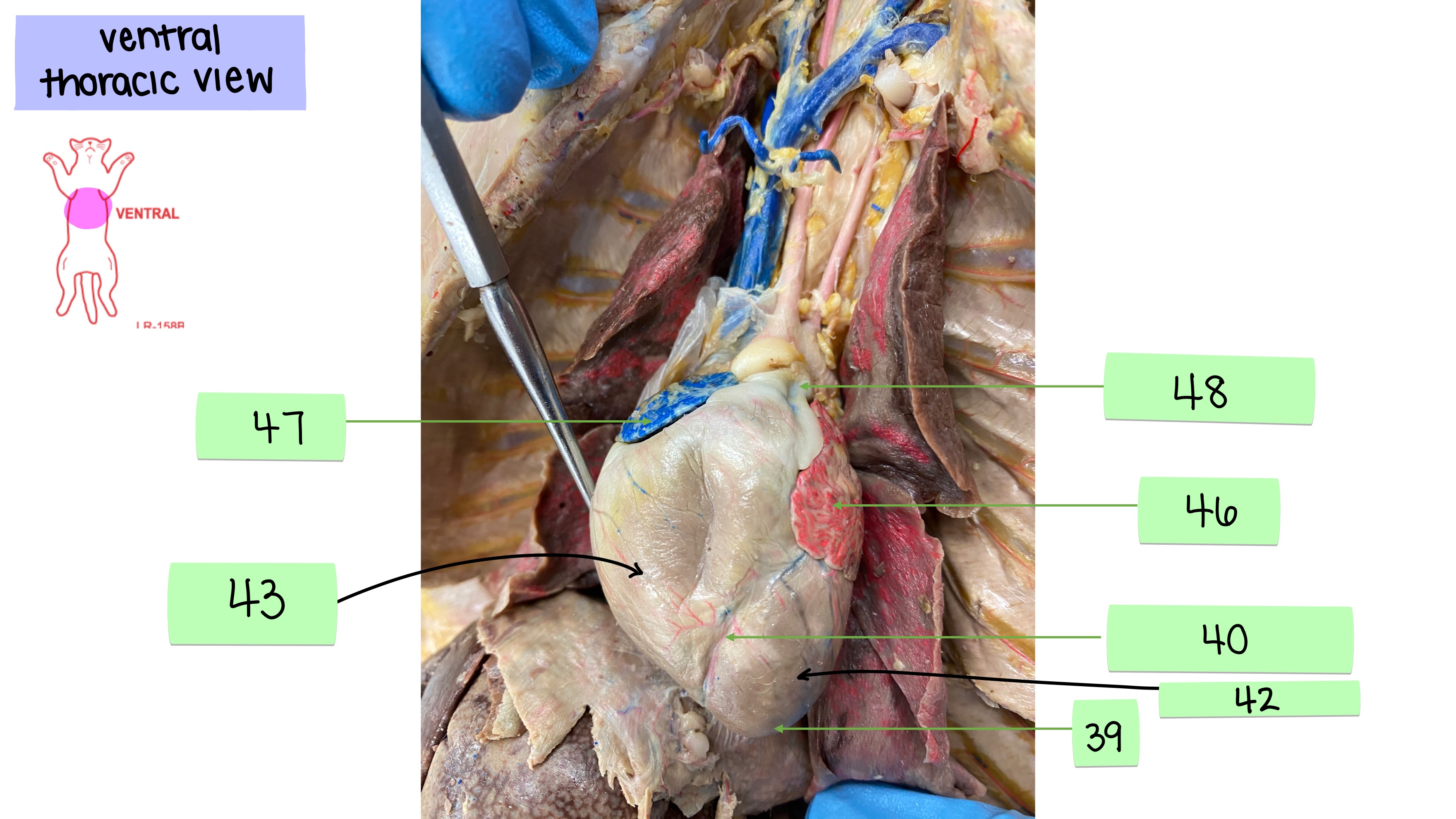 <p>right ventricle</p>