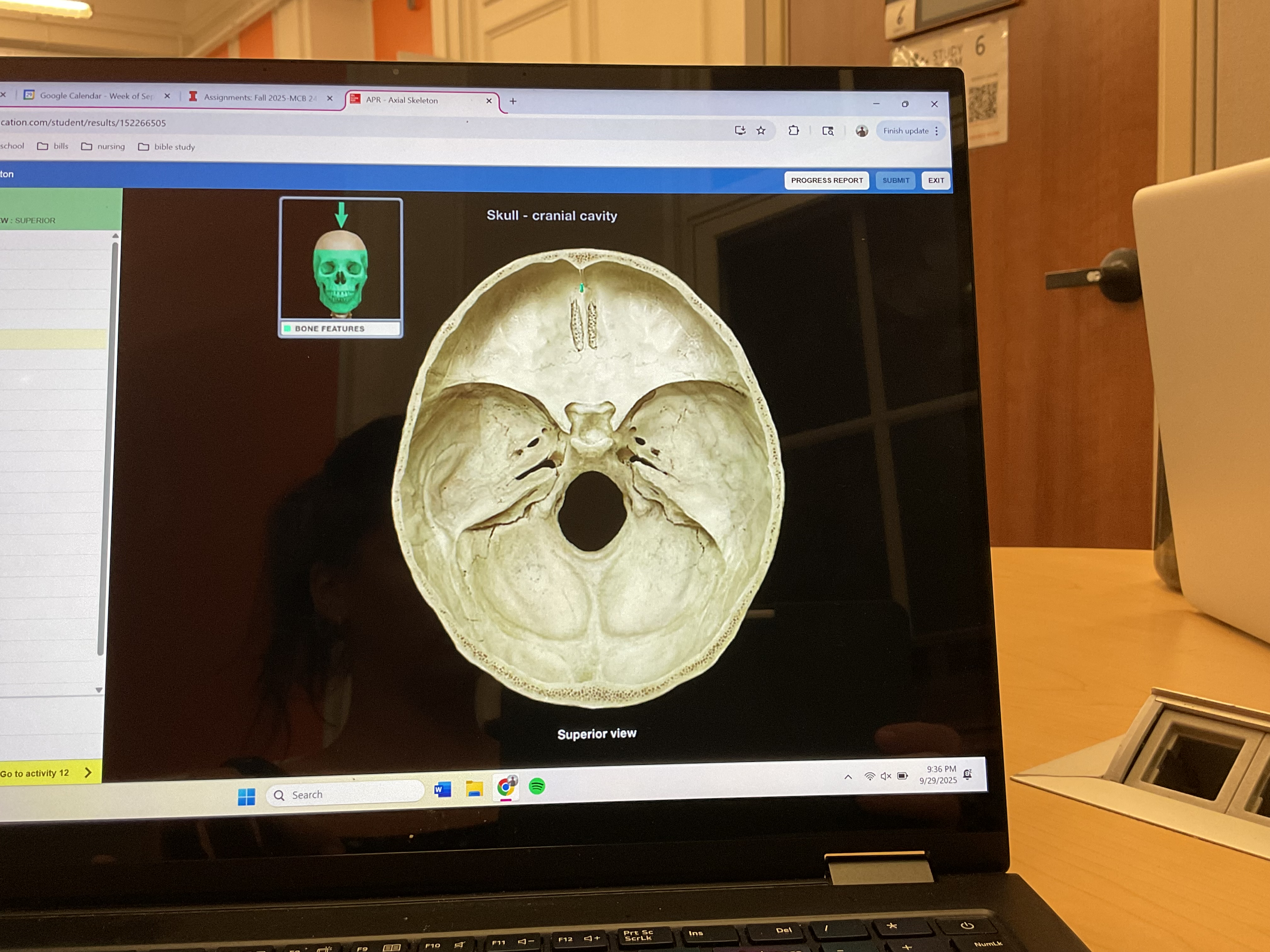 <p>Foramen cecum of skull </p>