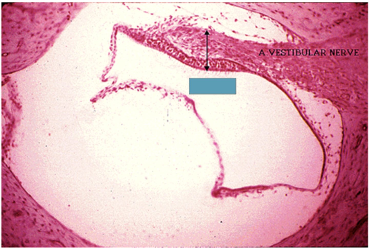 <p>Identify the following structure</p>