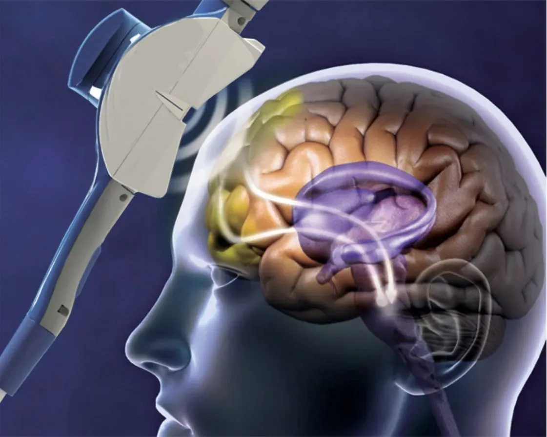 <p>What method of studying the brain is this?&nbsp;</p>