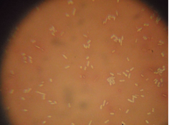 <p>What kind of stain, + or -, what kind of bacteria?</p>
