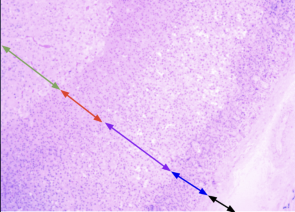 <p>What region is indicated by the red arrow?</p>