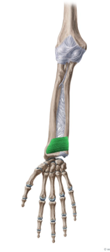 <p>What is this muscle called?</p>
