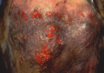 <ul><li><p>Aquatic </p></li><li><p><span style="color: rgb(136, 136, 136);"><strong>Et: </strong></span>Pythium insidiosum deep skin infection</p><ul><li><p><strong>parasitic oomycete, not true fungus</strong></p></li></ul></li><li><p><span style="color: rgb(136, 136, 136);"><strong>Sig:</strong> </span>Lg-breed, young male dogs <strong>w/ outdoor, water exposure, </strong>Gulf Coast US</p></li><li><p><span style="color: rgb(136, 136, 136);"><strong>Cs: Rare to have both forms</strong></span></p><ul><li><p><strong>Cutaneous:</strong> <strong><u>firm boggy masses, ulceration, draining tracts, severe pruritus, self-mutilation, Extremely pruitic</u></strong></p></li><li><p><strong>GI:</strong> vomiting, diarrhea, weight loss, <strong>segmental thickening of GI tract, mesenteric LN involvement</strong></p></li></ul></li><li><p><span style="color: rgb(136, 136, 136);"><strong>Dt:</strong></span><strong> cytology</strong>/biopsy (<u>pyogranulomatous w/ eosinophils w/ clear hyphae</u>)</p><img src="https://knowt-user-attachments.s3.amazonaws.com/4bc27e03-ead7-4be0-8ba7-e9d7fe7e37a4.png" data-width="50%" data-align="center"></li><li><p><span style="color: rgb(136, 136, 136);"><strong>Tx<u>: </u></strong></span><strong><u>Sx excision/amputation (#1)</u></strong></p><ul><li><p>antifungals ineffective</p></li></ul></li></ul><p></p>