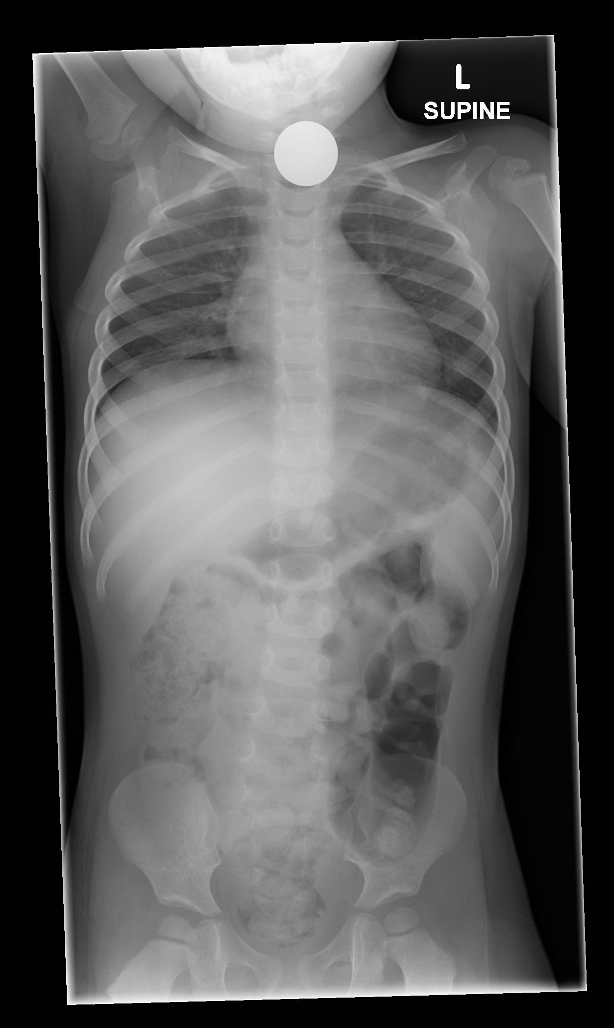 <p>From nasopharynx to anus.</p>