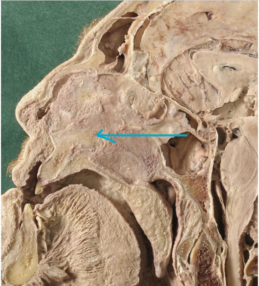 <p>what structure?</p>