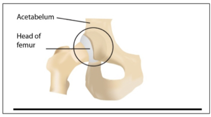 term image