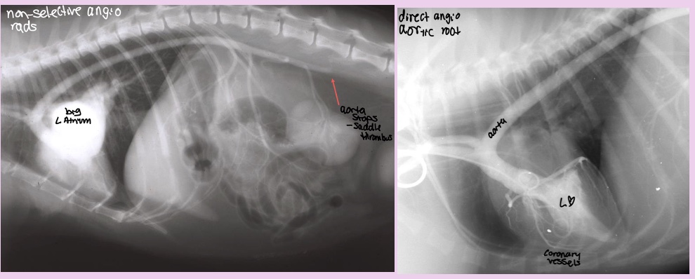 <p>Contrast injected in peripheral vein vs Cather in area of interest</p>