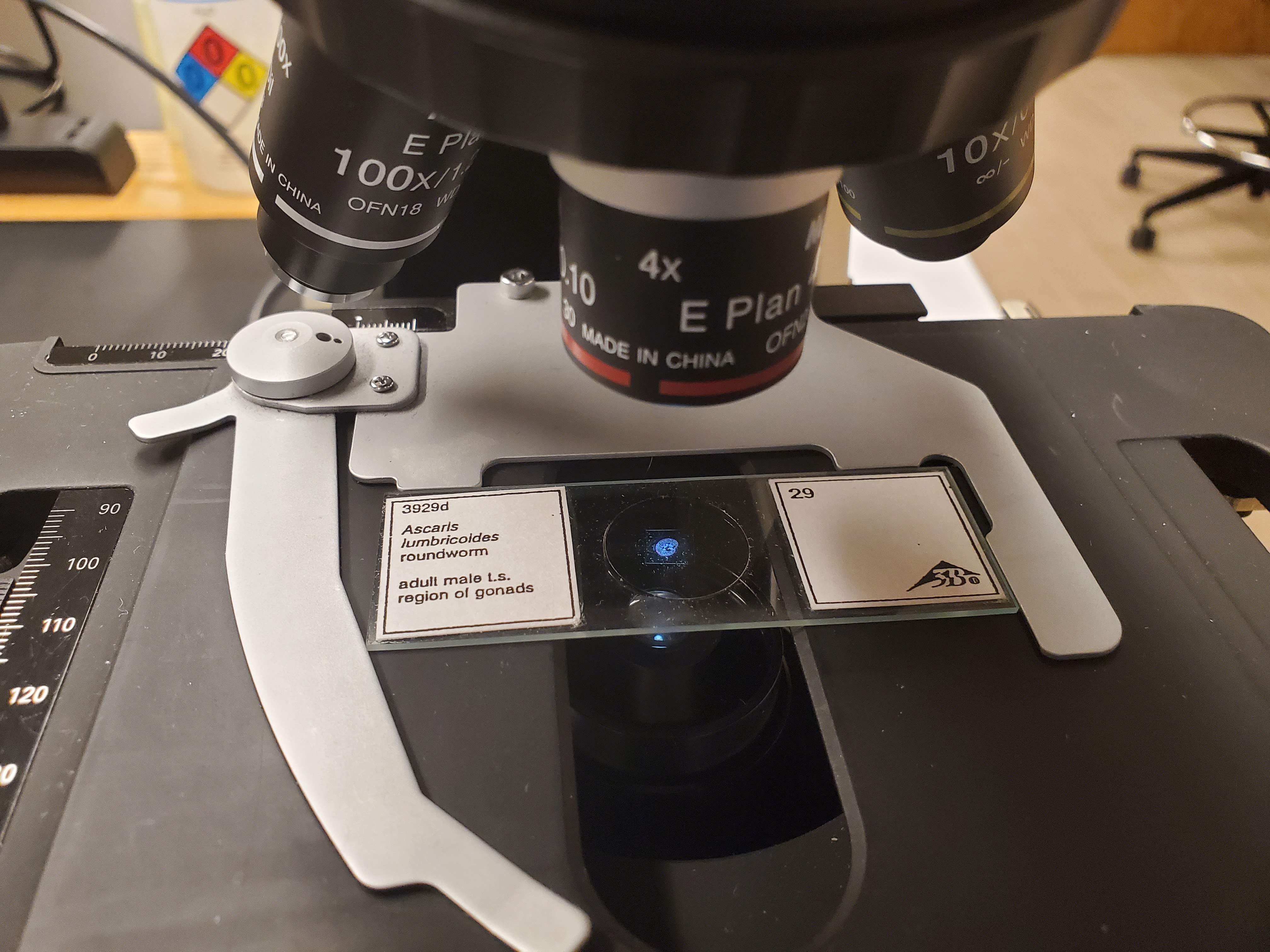 <p>Ascaris lumbricoides male</p>