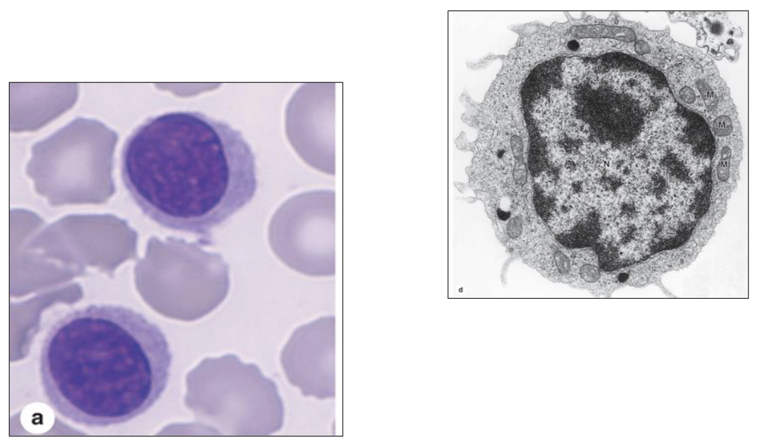 <p>What type of cell is seen here?</p>