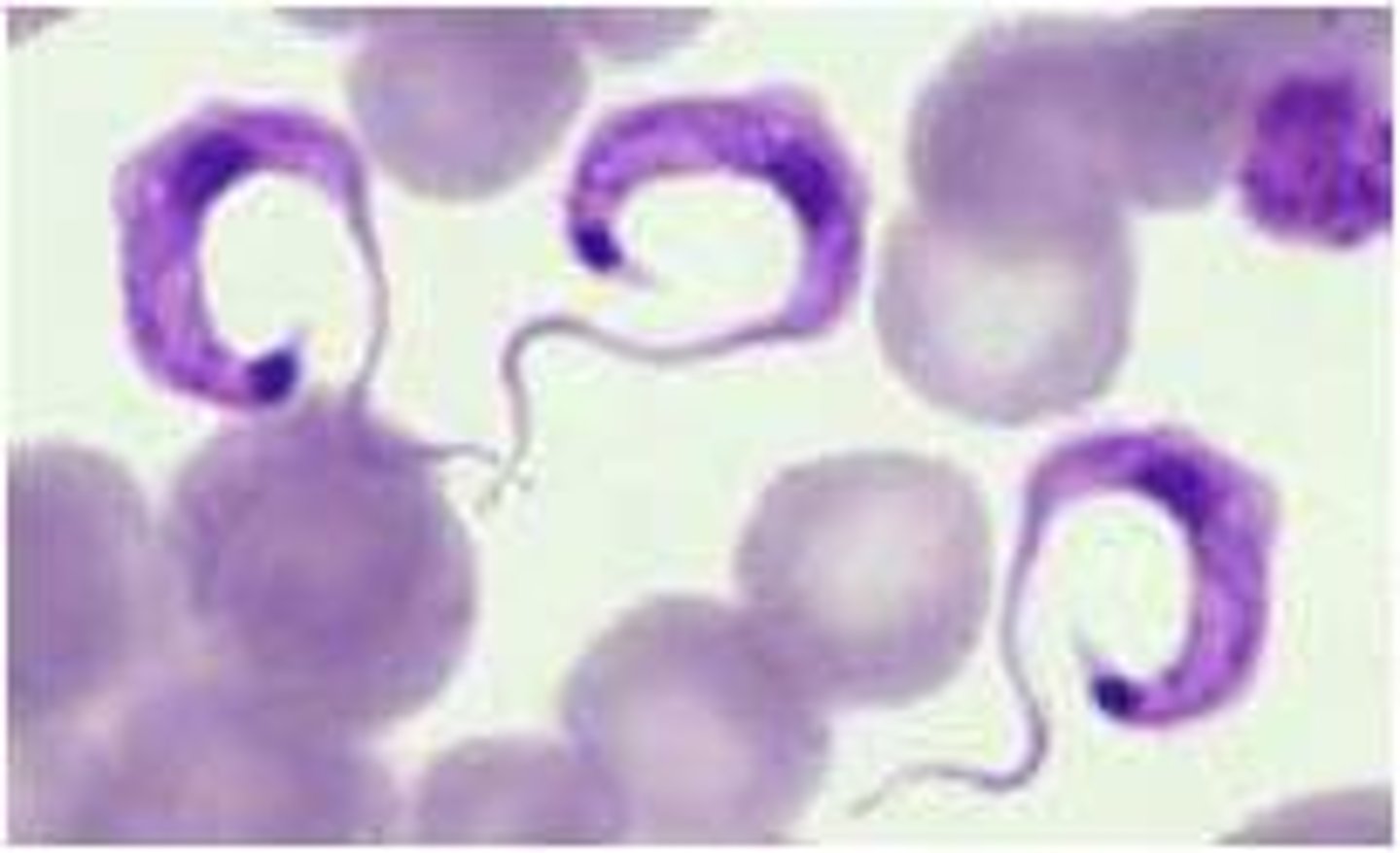 <p>AMERICAN TRYPANO (south and central america)</p><p>-trypomastigote in blood</p><p>-causes CHAGAS disease!!!</p><p>*mostly asymptomatic</p><p>*ACUTE: romana's sign (eye swelling)</p><p>*CHRONIC: mega-syndromes</p><p>-C SHAPE!</p><p>-undulating membrane</p><p>-flagella, large, bulging kinetoplast that fills the posterior portion</p><p>-KISSING BUG is the vector</p><p>-more C shaped and the kinetoplast iS MUCH BIGGER!!!!!</p>