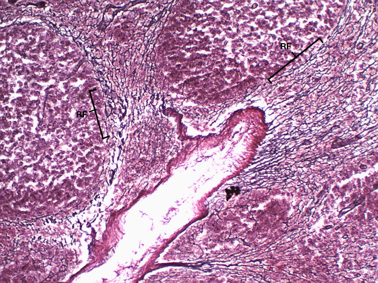 <p>Reticular Connective Tissue — Function</p>