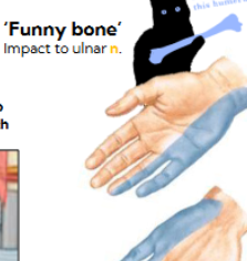 <p>Impact to the ulnar nerve</p>