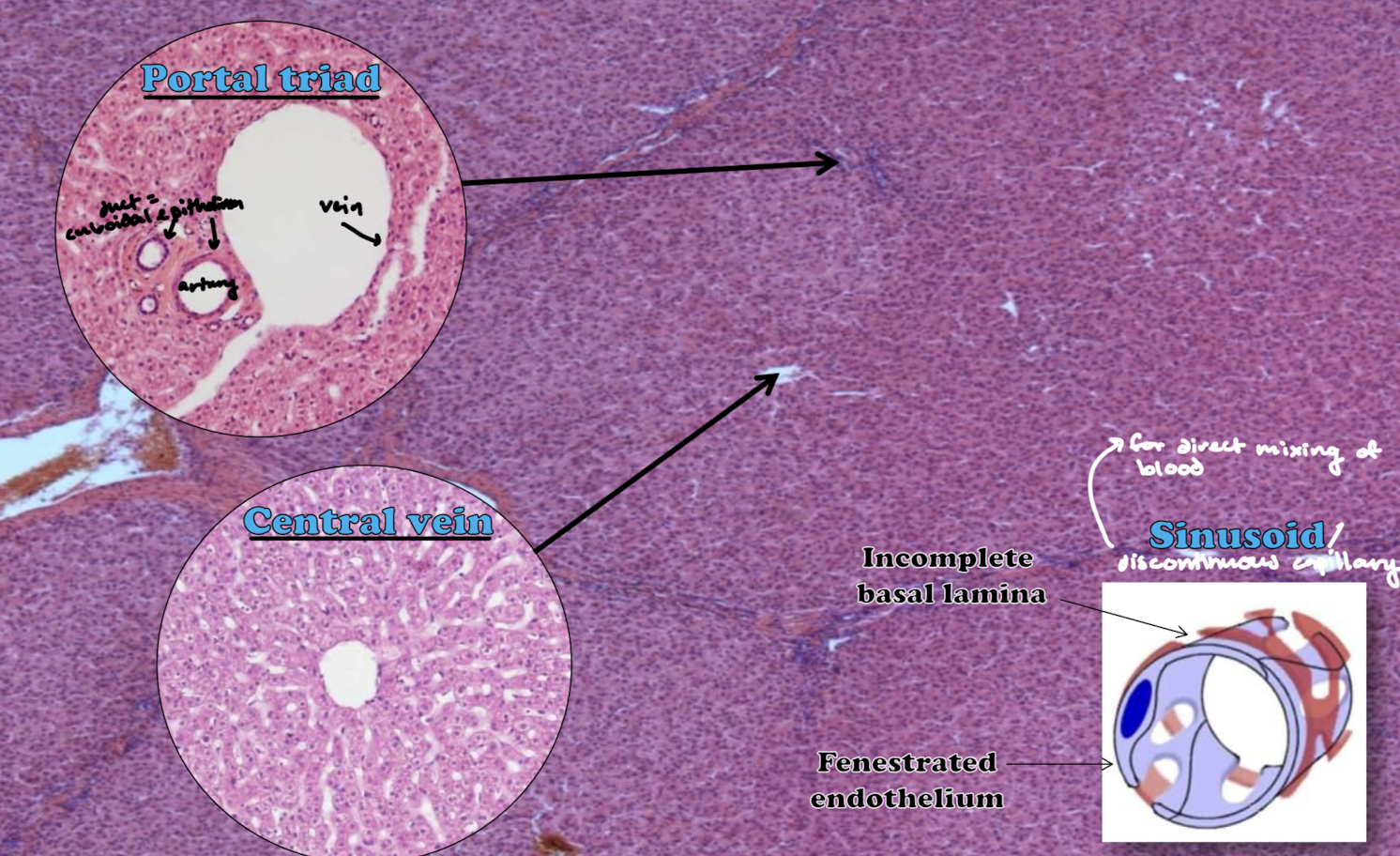 <p>Large capillaries that carry blood through the lobule from periphery to the central vein. Contains fenestrated endothelium with incomplete/discontinuous basal lamina. They contain a mixture of arterial blood (hepatic artery) and venous blood (hepatic portal vein). </p>
