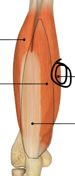 <p>triceps brachii m. (long)</p><p>O: Inferior glenoid fossa <br>I: Olecranon process of ulna<br>A: <span>Extends elbow and adduction of humerus</span><br>N: Radial n.</p>