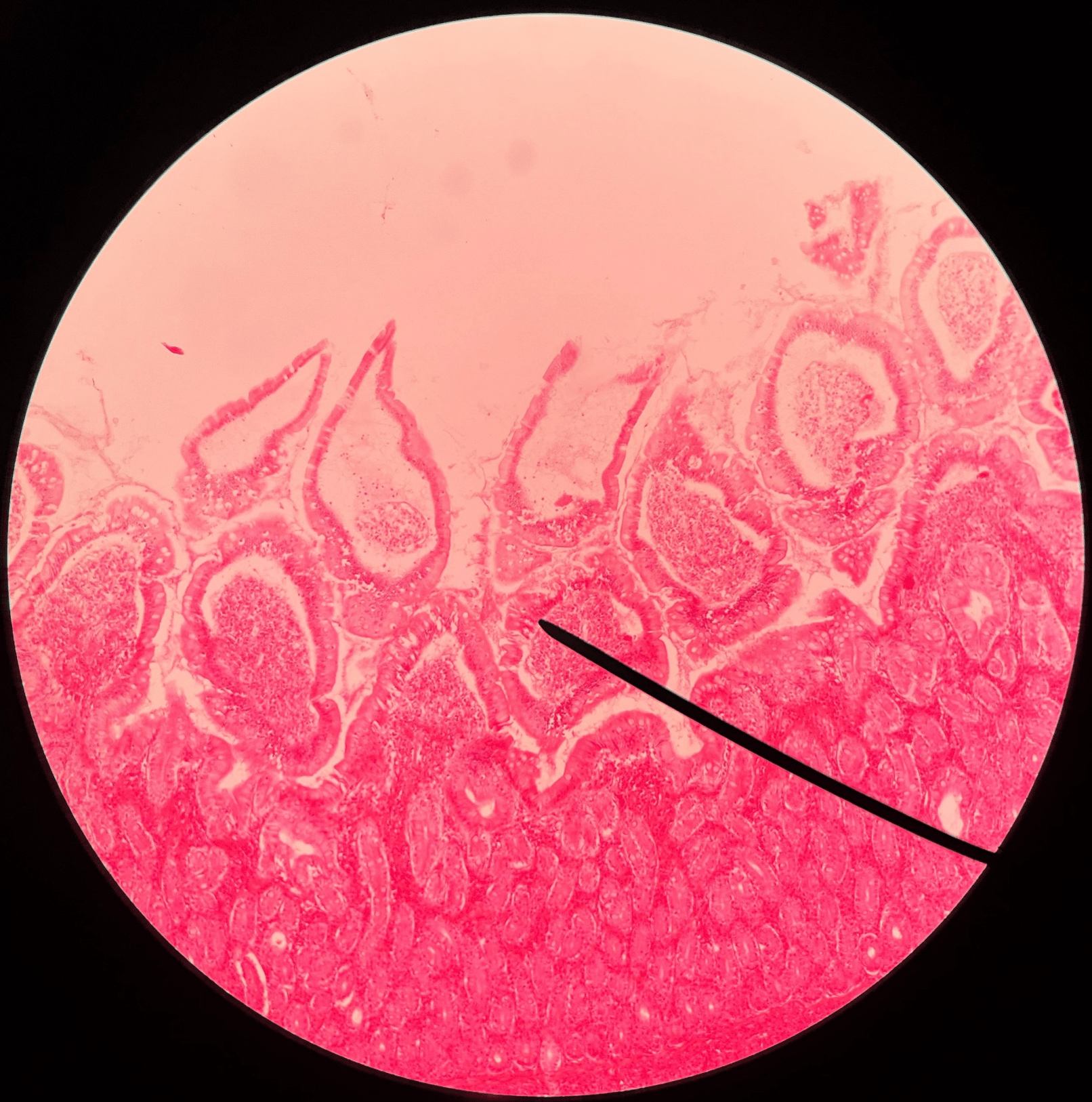 • Slide histology of the duodenum.

• Located in the mucosa layer of the duodenum.

• Increases the absorptive surface of the lining epithelium.