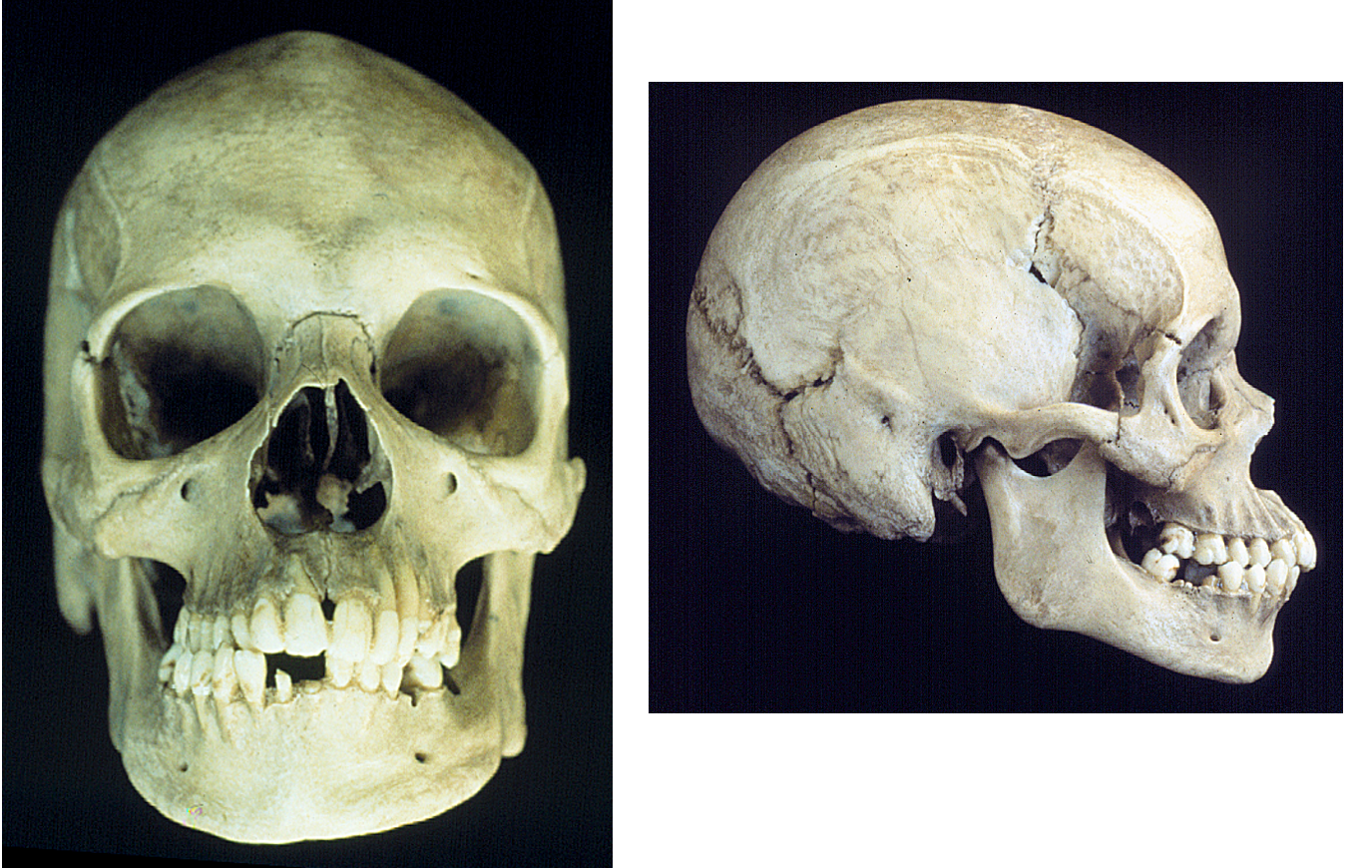 <p>Of what ancestry is this skull?</p>