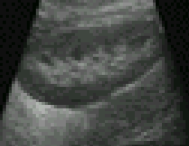<p>What position could this image have been taken in?</p>