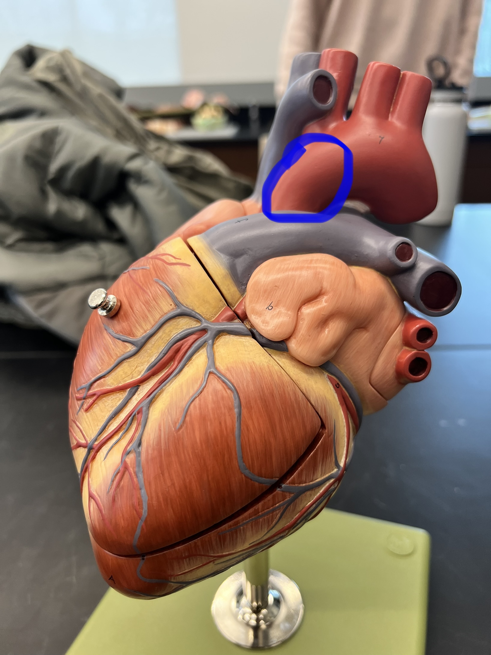 Name the heart structure.